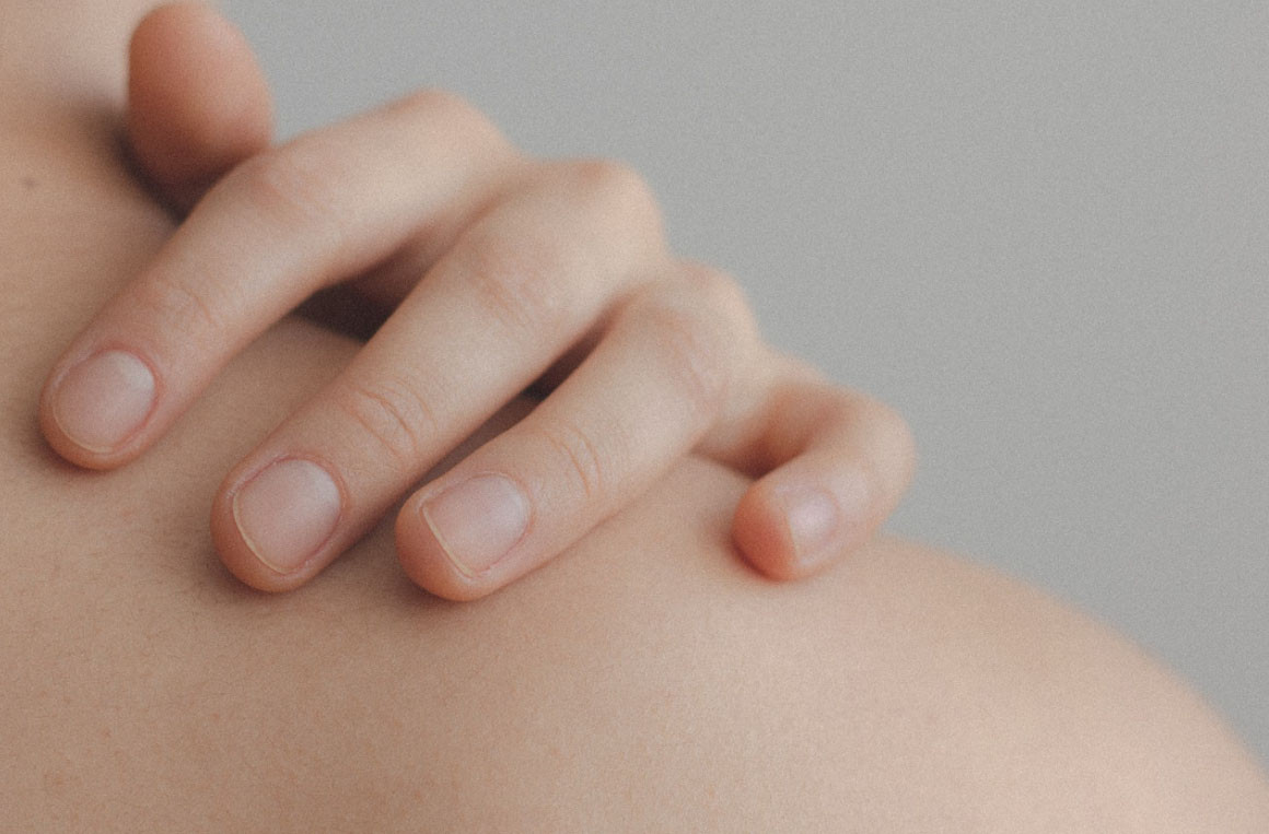 Psoriasi contagiosa, un falso mito